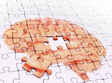 Alzheimer Belirtisine İşaret Eden 10 Önemli Soru